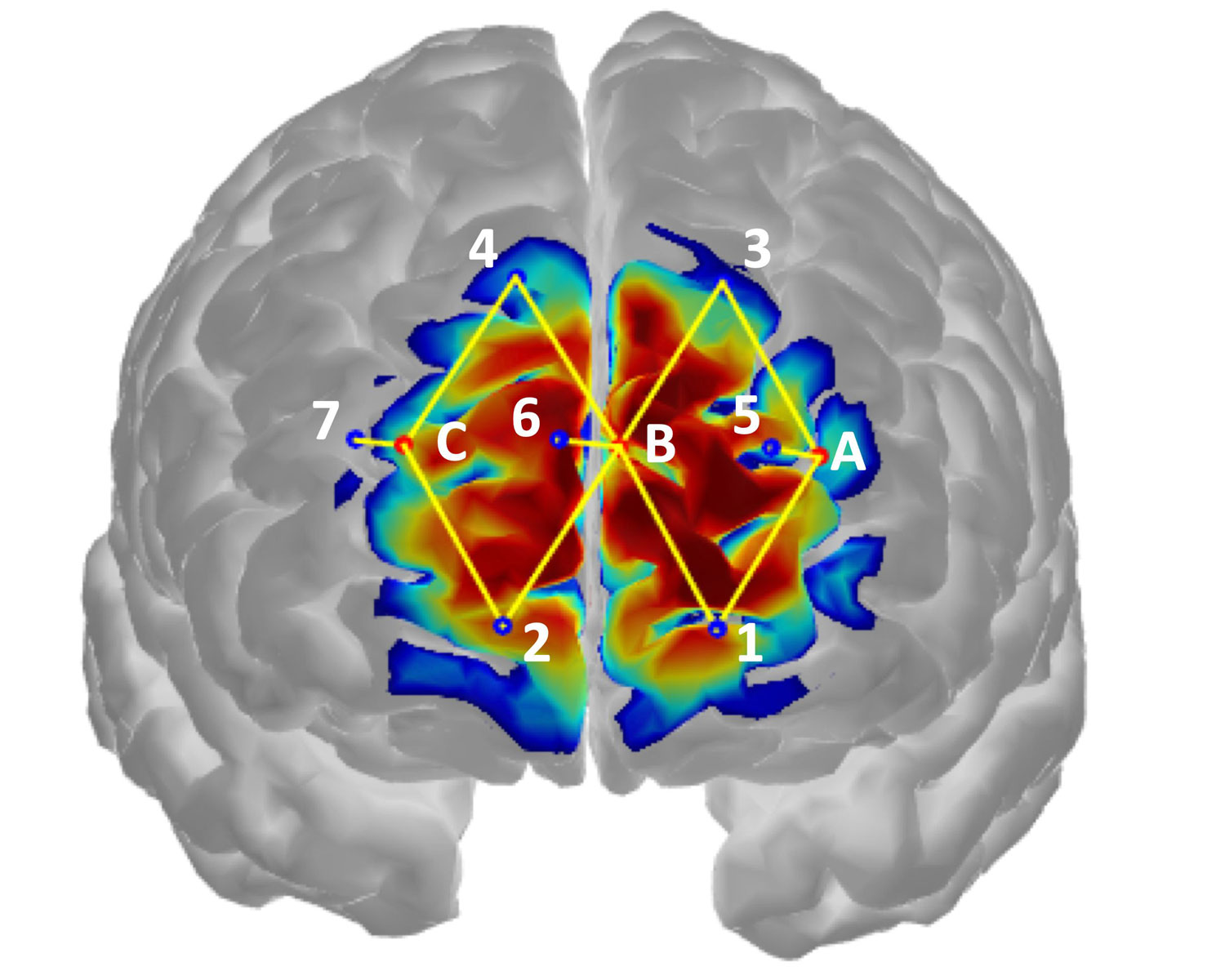 Brain activity detecting pain